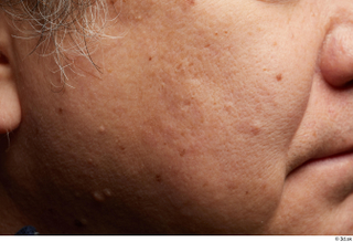 HD Face Skin Alfredo Zorita cheek face skin texture wrinkles…